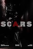 Scars