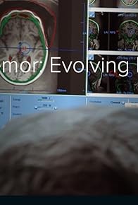 Primary photo for Essential Tremor: Evolving Innovations in Treatment