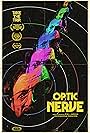 Optic Nerve