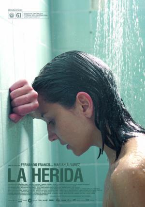 La herida 