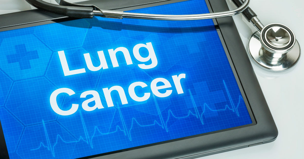 Lung-Cancer-Detection