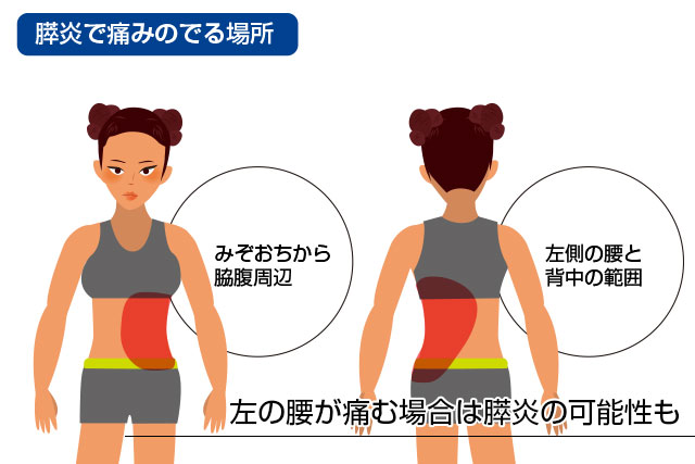 左の腰が痛む場合は膵炎の可能性も