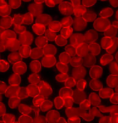 File:Sedimented red blood cells2.jpg