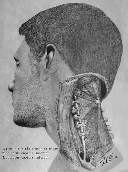 File:Suboccipital triangle dissection.jpg