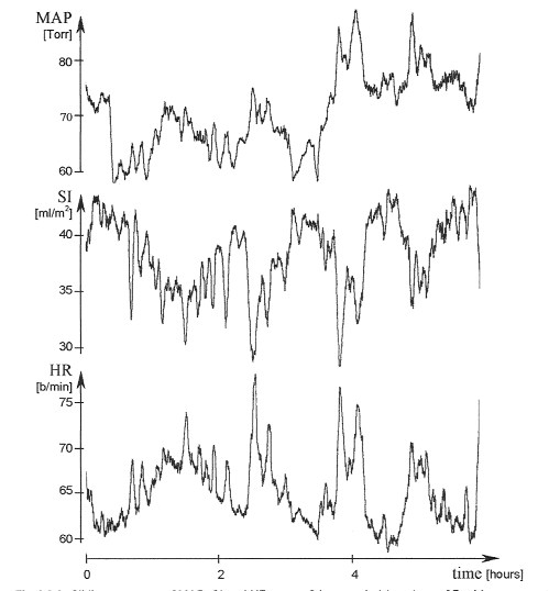 File:Chronotropic compensation of CI over a 6-hour period.png