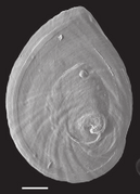 July 5: The inner side of the operculum of Marstonia comalensis. Scale bar: 200 μm.