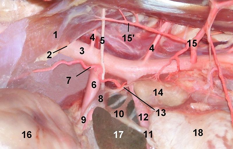 File:Celiac ganglion.jpg