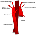 Diverticolo di Kommerel