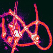 December 9: Ebolavirus particles