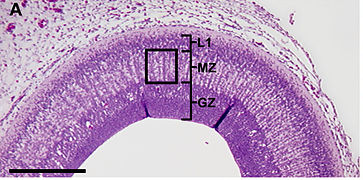 April 9: HE staining of chicken optic tectum with the layered subventricular zone. Scale bar 200 μm. .