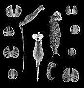 June 27: Scanning electron micrographs showing morphological variation of bdelloid rotifers and their jaws.