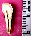 Cross-section of anterior tooth