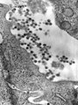 Rubella virus budding from the host cell surface