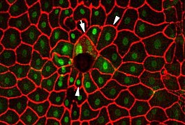 Februrary 28: Fluorescence microscopy of wound healing in Drosophila.