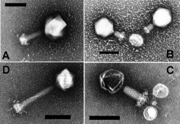 December 24: Electron microscopy of Prochlorococcus