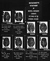 An image depicting the comparison of brain types to criminality.