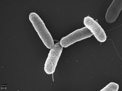 April 26: Salmonella enterica ssp. enterica ser. Typhimurium.