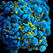 HIV H9 T-cell.jpg