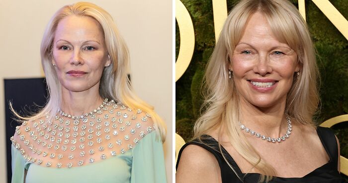 “She's Definitely Cheating”: Pamela Anderson’s Golden Globes Makeup Sparks Controversy