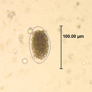 Trichostrongylus egg wtmt HB1.jpg