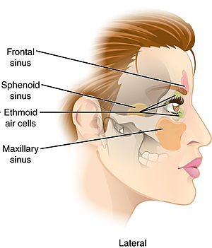 Paranasal Sinuses lat.jpg