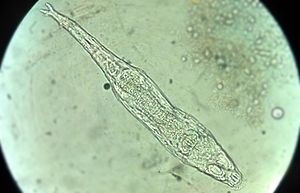 Rotifera microscopic view.jpg