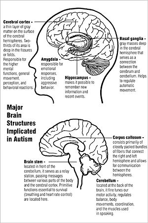 Two diagrams of major brain structures implicated in autism. The upper diagram shows the cerebral cortex near the top and the basal ganglia in the center, just above the amygdala and hippocampus. The lower diagram shows the corpus callosum near the center, the cerebellum in the lower rear, and the brain stem in the lower center.