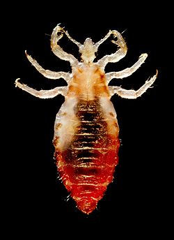 Body lice.jpg