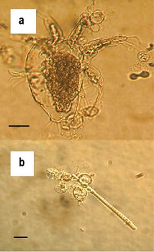 Batrachochytrium dendrobatidis.jpg