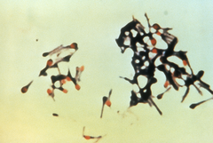 Clostridium tetani 01.png