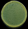 Plaques of lambda phage growing on Escherichia coli