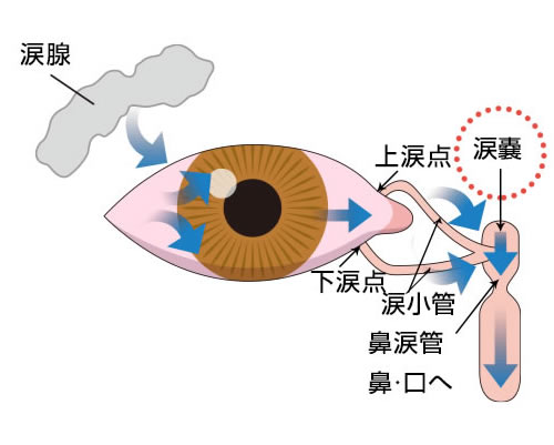 涙嚢炎