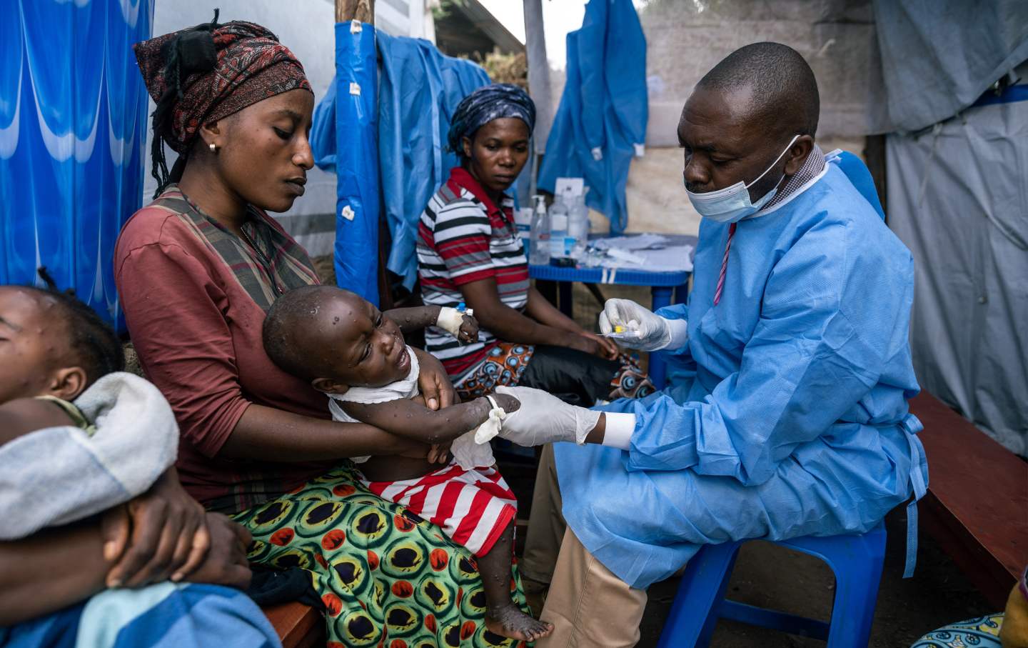 A mother holds her son as he receives his daily injection while being treated for mpox at the Kavumu health center in Kabare territory, South Kivu region, Democratic Republic of Congo, on Tuesday, Sept. 3, 2024.