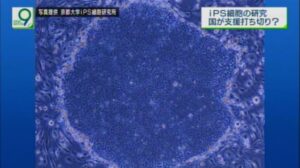 ”もう支援はしない” 揺れたｉＰＳ細胞研究